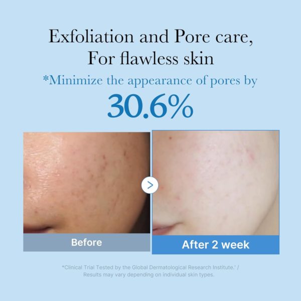 Medicube Zero Pore Toner I Exfoliating & Hydrating Blue Bottle Water Toner with AHA, BHA, PHA, Niacinamide, and Panthenol | Korean Skin Care for Pores, Texture, and Moisture Care (8.45 fl. oz.). - Image 5