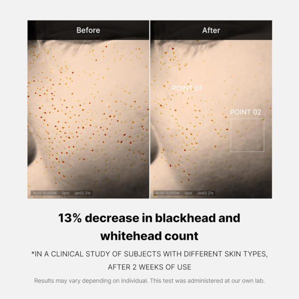 Medicube Zero Pore One-day Serum 1.01 fl.oz – Overnight Resurfacing Serum with Pore Tightening Complex – 15.2% AHA+BHA+PHA & 2% Niacinamide – 10.8% reduction in pore appearance after one day of use - Image 4