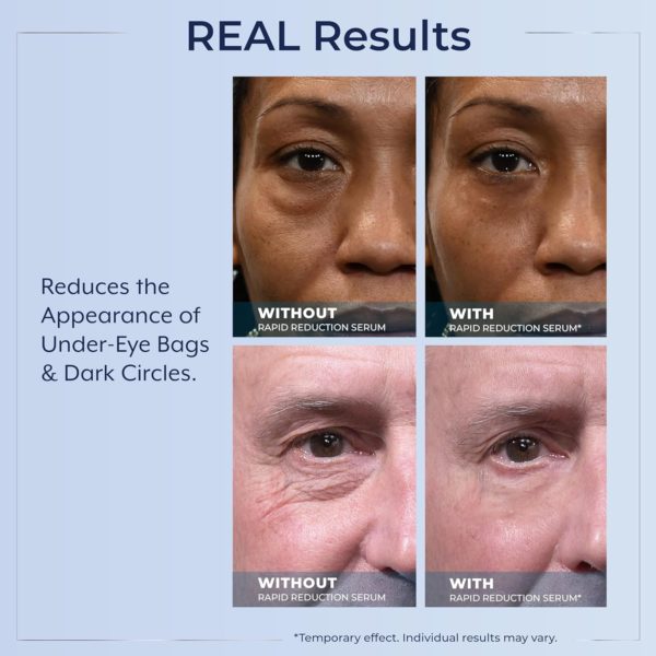 Plexaderm Rapid Reduction Eye Serum – Visibly Reduces Under-Eye Bags, Wrinkles, Dark Circles, Fine Lines & Crow’s Feet Instantly, Anti Aging Wrinkle Remover for Face, Full Size Tube - Image 5